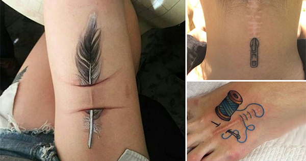 24 Amazing Tattoos That Turn Scars Into Works Of…