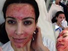 The Weirdest Facials People Have Actually Dared To Try